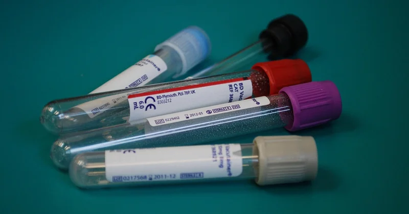 Des essais cliniques aux résultats contrastés mais encourageants
